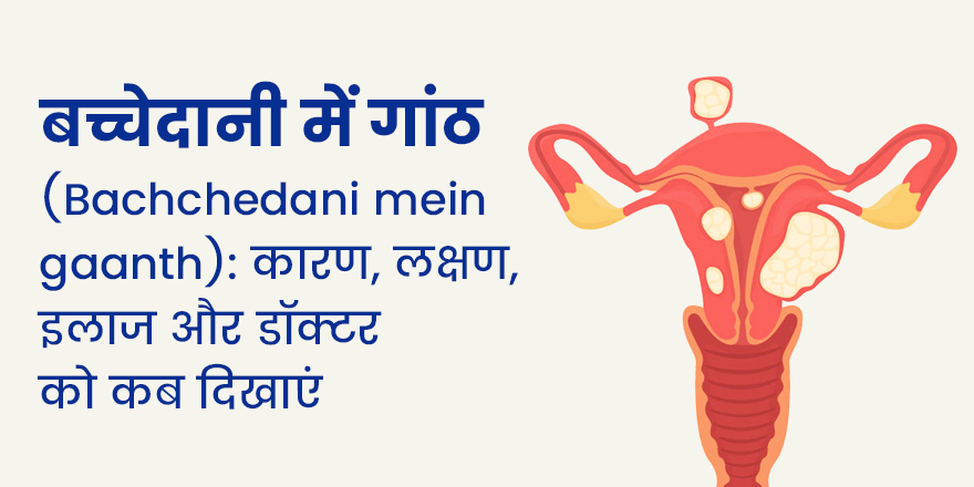 बच्चेदानी में गांठ (bachchedani mein gaanth): कारण, लक्षण, इलाज और डॉक्टर को कब दिखाएं